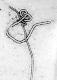 Einzelnes Ebola-Virus.